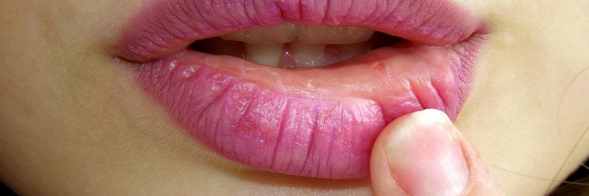 Can lip fillers go wrong?