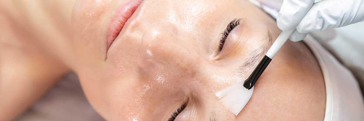 Chemical peels benefits, Radiant complexion treatments, Types of chemical peels, Skin rejuvenation