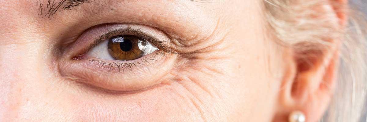 Laser therapy for wrinkles, Fine line reduction, Youthful skin treatments, Laser skin resurfacing