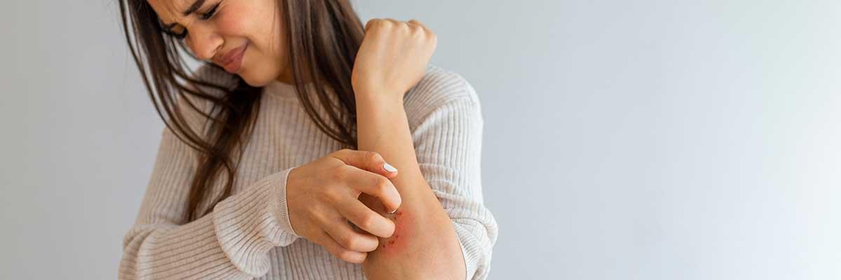 Aesthetic Management for Eczema and Psoriasis: Techniques & Relief