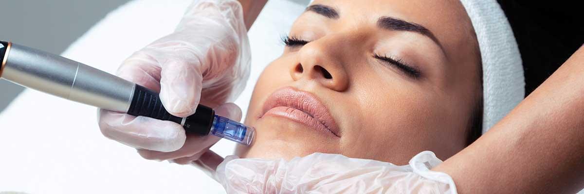 Microneedling benefits, Deep skin repair treatment, Collagen induction therapy, Microneedling for scars